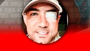 Marcos Yaroide revela que fue operado de emergencia por desprendimiento de retina