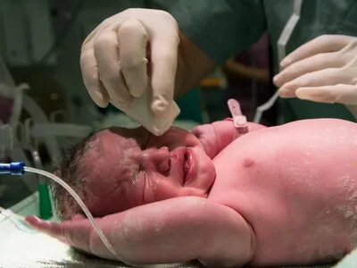 Parto vaginal o cesárea: beneficios y riesgos de ambas vías